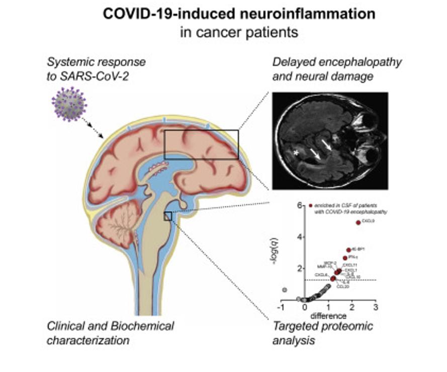 MEDI:GATE NEWS How does COVID-19 cause brain damage?